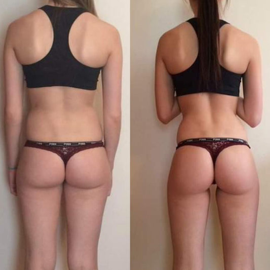 Can Creatine Help with Booty Gain?